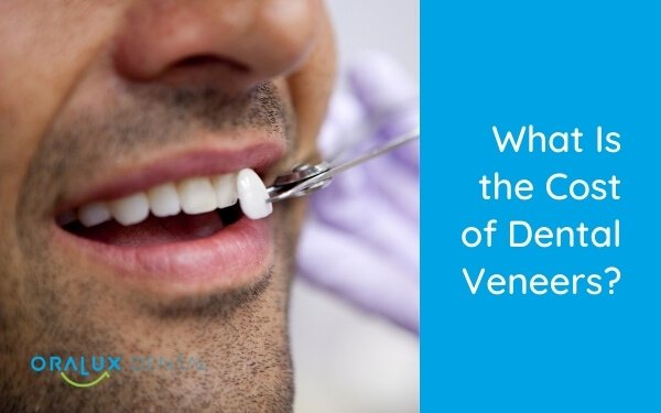 What Is The Cost Of Dental Veneers?